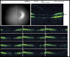 RADIAL LINE OD